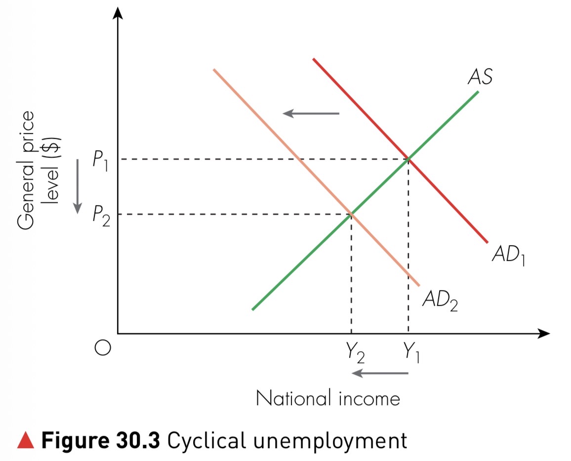 Figure 30.3 Cyclical unemployment shown by a fall in aggregate demand